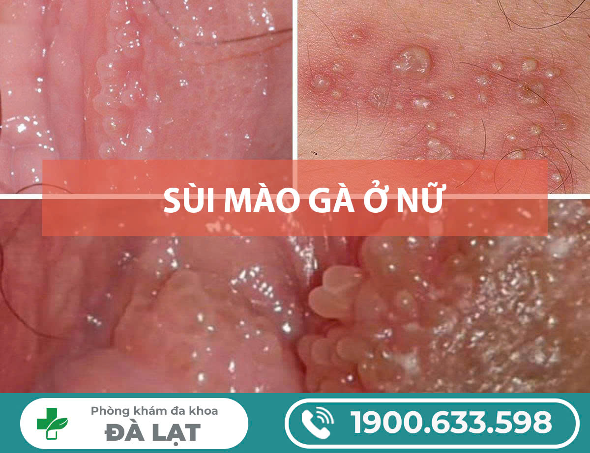 Hình ảnh minh họa